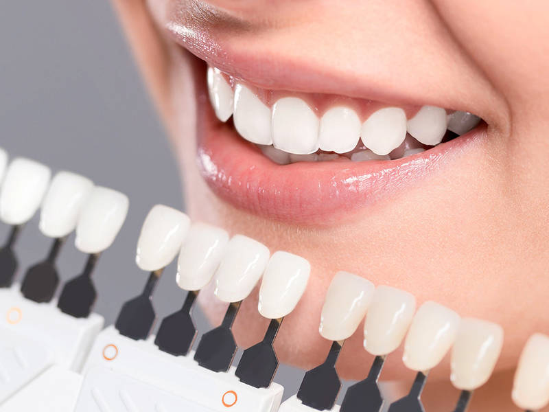 Răng Bị Nứt Có Nguy Hiểm Không Dấu Hiệu, Nguyên Nhân Và Cách Điều Trị (10)