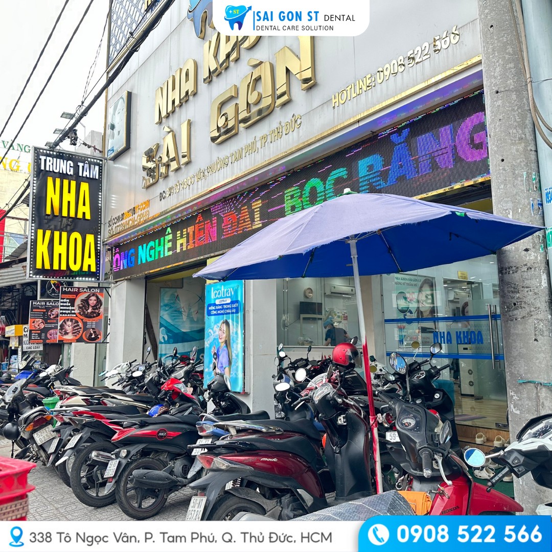 Răng Bị Nứt Có Nguy Hiểm Không Dấu Hiệu, Nguyên Nhân Và Cách Điều Trị (12)