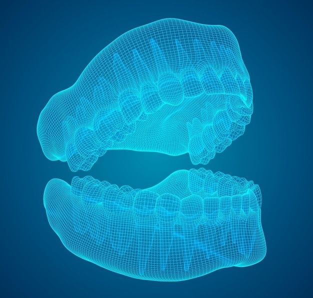 Scan RĂng 3d Khi ChỈnh Nha LÀ GÌ Quy TrÌnh Scan RĂng 3d Ra Sao