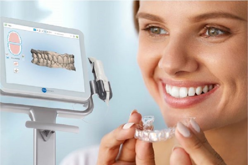 Scan RĂng 3d Khi ChỈnh Nha LÀ GÌ Quy TrÌnh Scan RĂng 3d Ra Sao