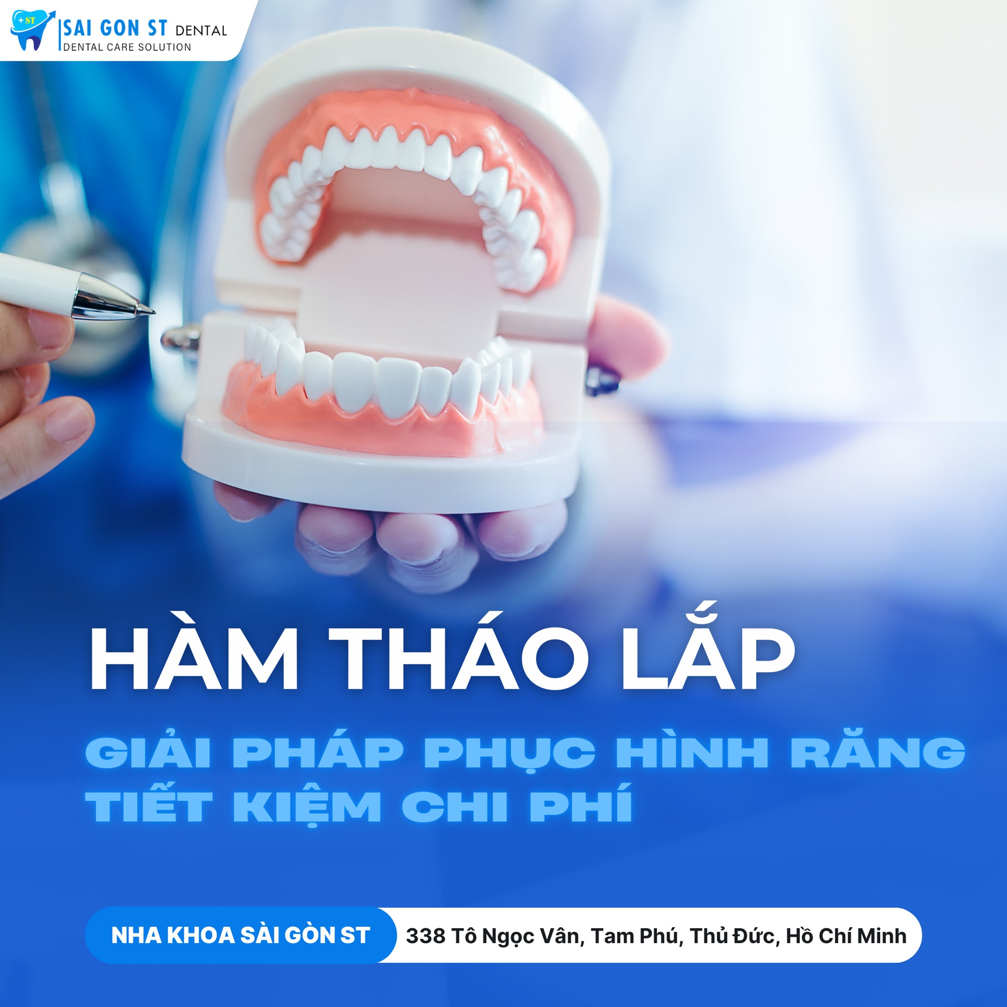 Tìm Hiểu 3 Giải Pháp Thay Thế Răng Mất Phổ Biến Hiện Nay