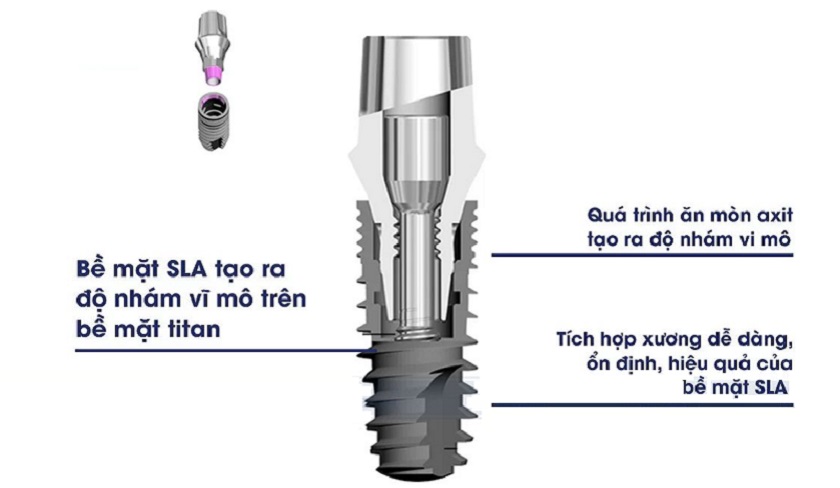 Dòng Trụ Impant