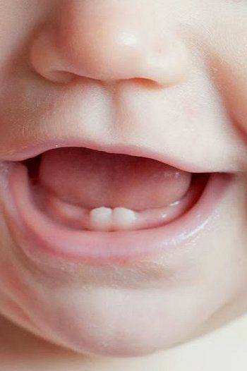 Răng Sữa Và Răng Vĩnh Viễn Ở Trẻ