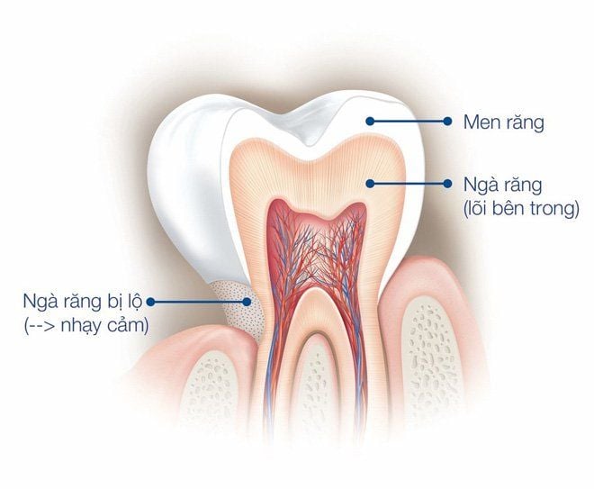 Dấu Hiệu Nhận Biết Răng Hư Tổn Và Phương Pháp Điều Trị