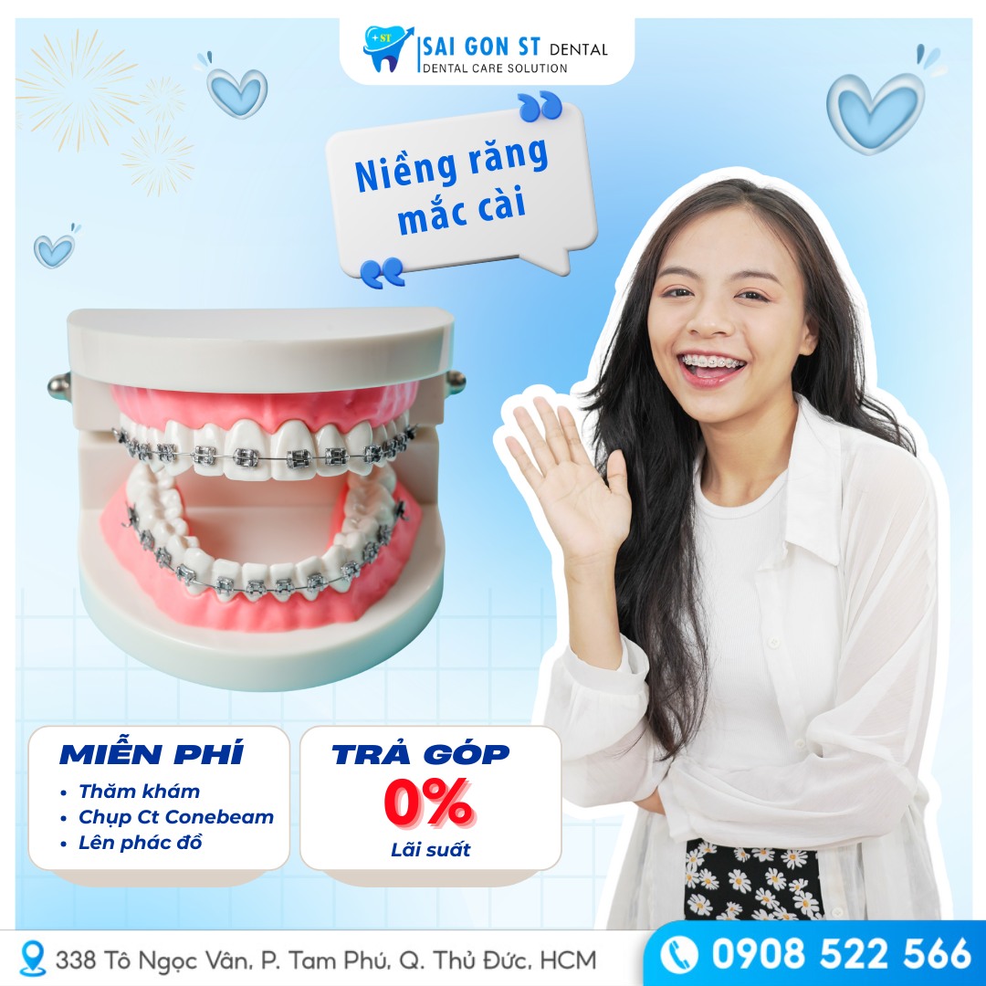 Niềng Răng Trả Góp Thủ Đức