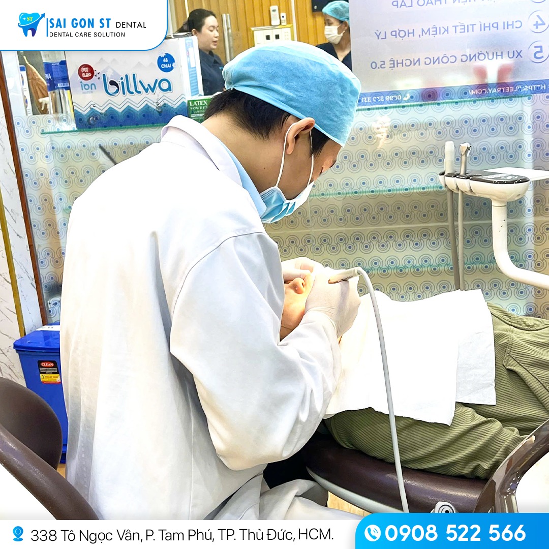 Tẩy Trắng Răng Bằng Laser Có Hại Không Chi Phí Như Thế Nào (2)