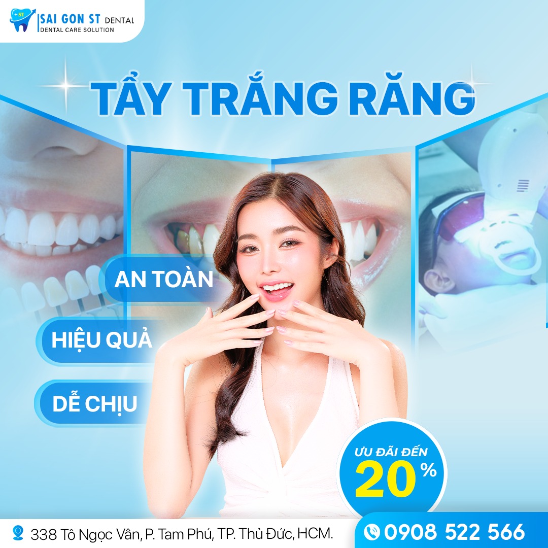 Tẩy Trắng Răng Bằng Laser Có Hại Không Chi Phí Như Thế Nào (5)