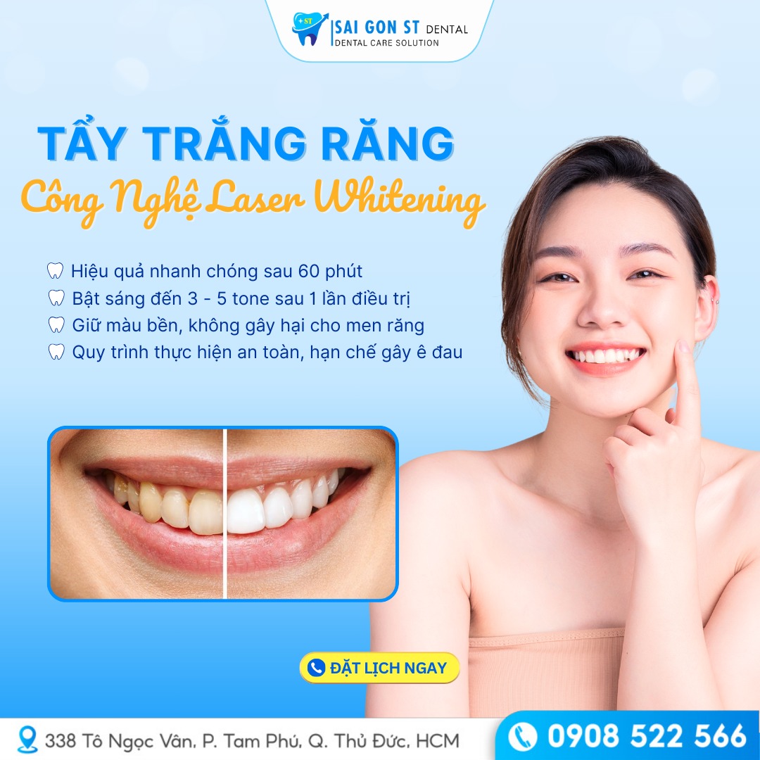 Tẩy Trắng Răng Bằng Laser Có Hại Không Chi Phí Như Thế Nào (6)
