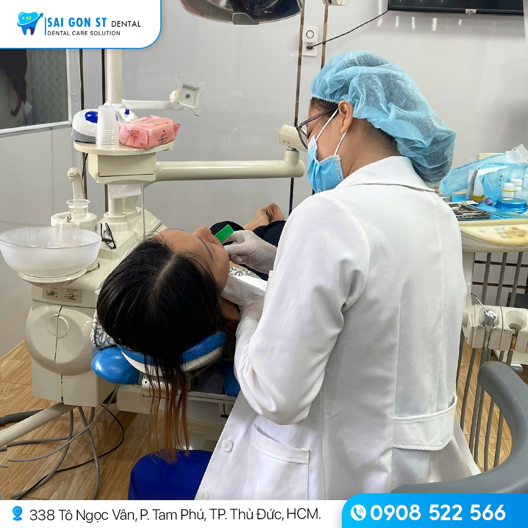 Viêm Nướu Là Gì Dấu Hiệu, Nguyên Nhân Và Cách Điều Trị