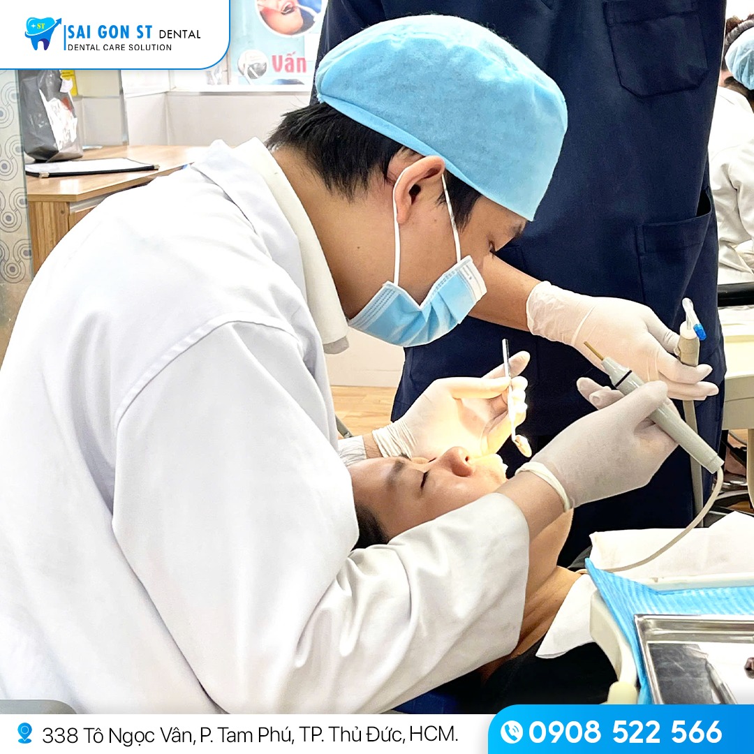 Công Nghệ Dán Sứ Veneer Siêu Mỏng